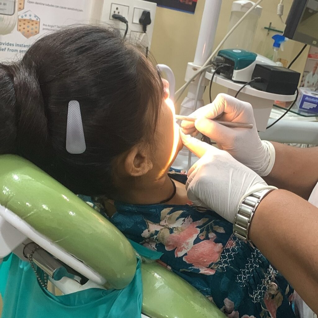 Root Canal Treatment