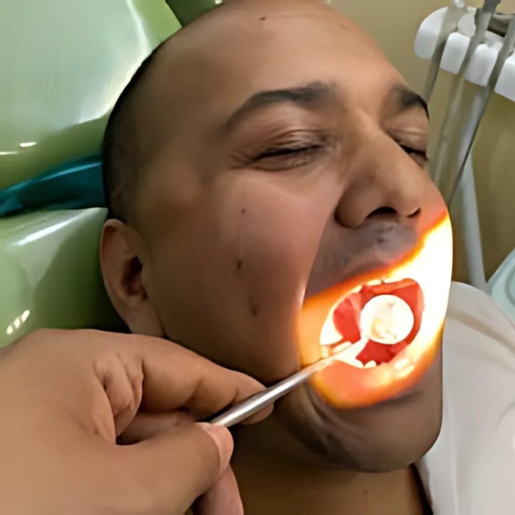 Teeth Scaling and whitening
